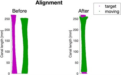 A statistical shape analysis for the assessment of the main geometrical features of the distal femoral medullary canal